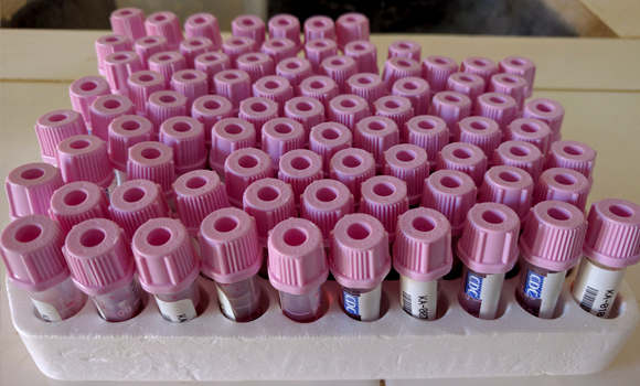 Blood sample collection tubes.