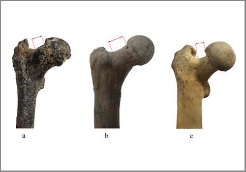 Could be the oldest known human': 7.2 million year old femur