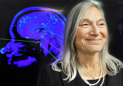 Gillian Einstein and a mri scan of a brain.