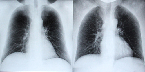 A side-by-side comparison of real and computer generated x-rays.