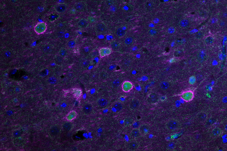 Microscope slide of the molecular network that surrounds neurons.